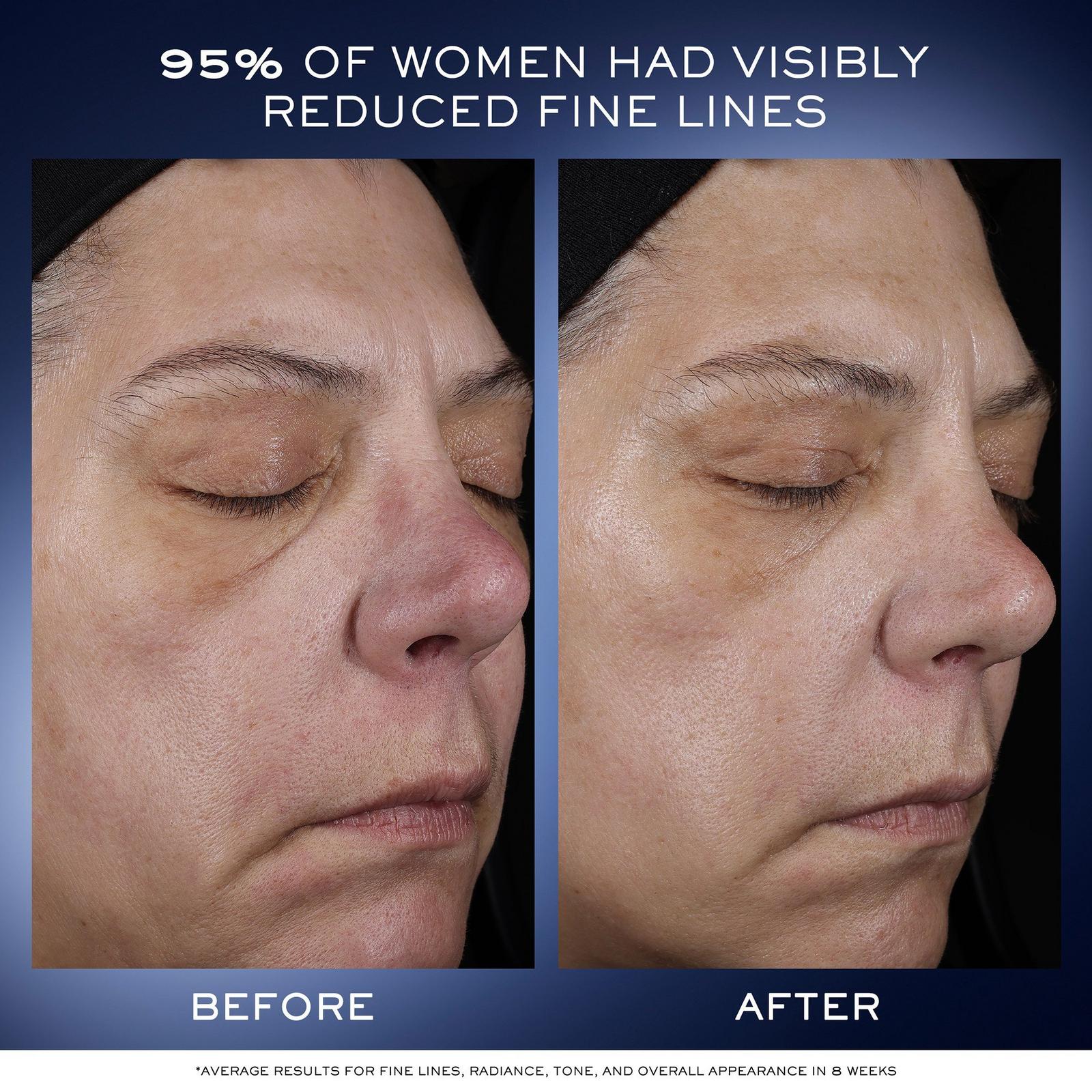 Génifique Ultimate Recovery Serum with Beta-Glucan - Lancôme