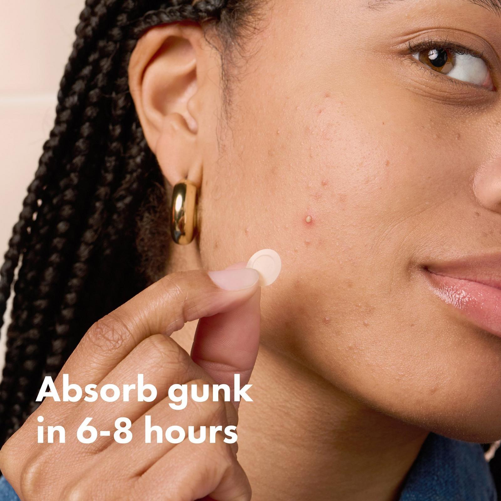 Mighty Patch Day & Night