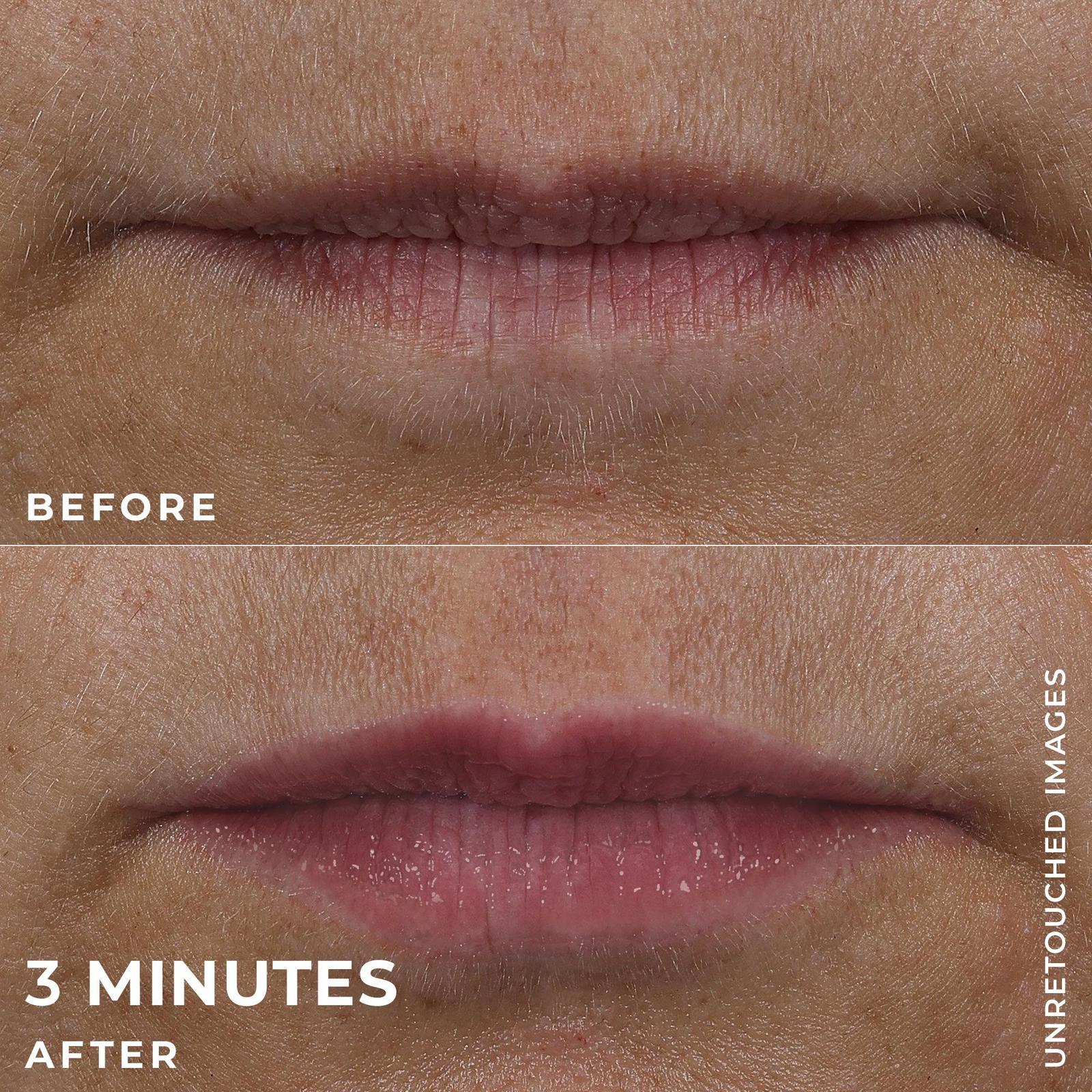 Lip Volumizer