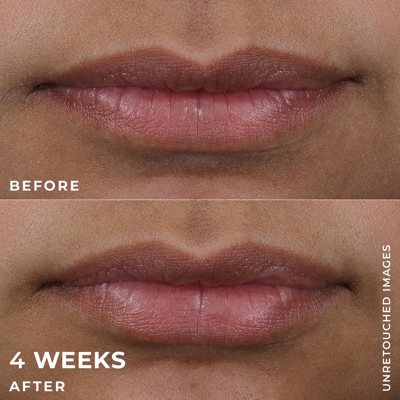 Lip Volumizer