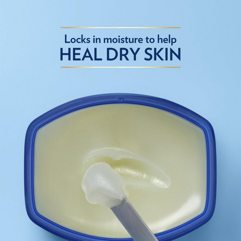 Healing Petroleum Jelly