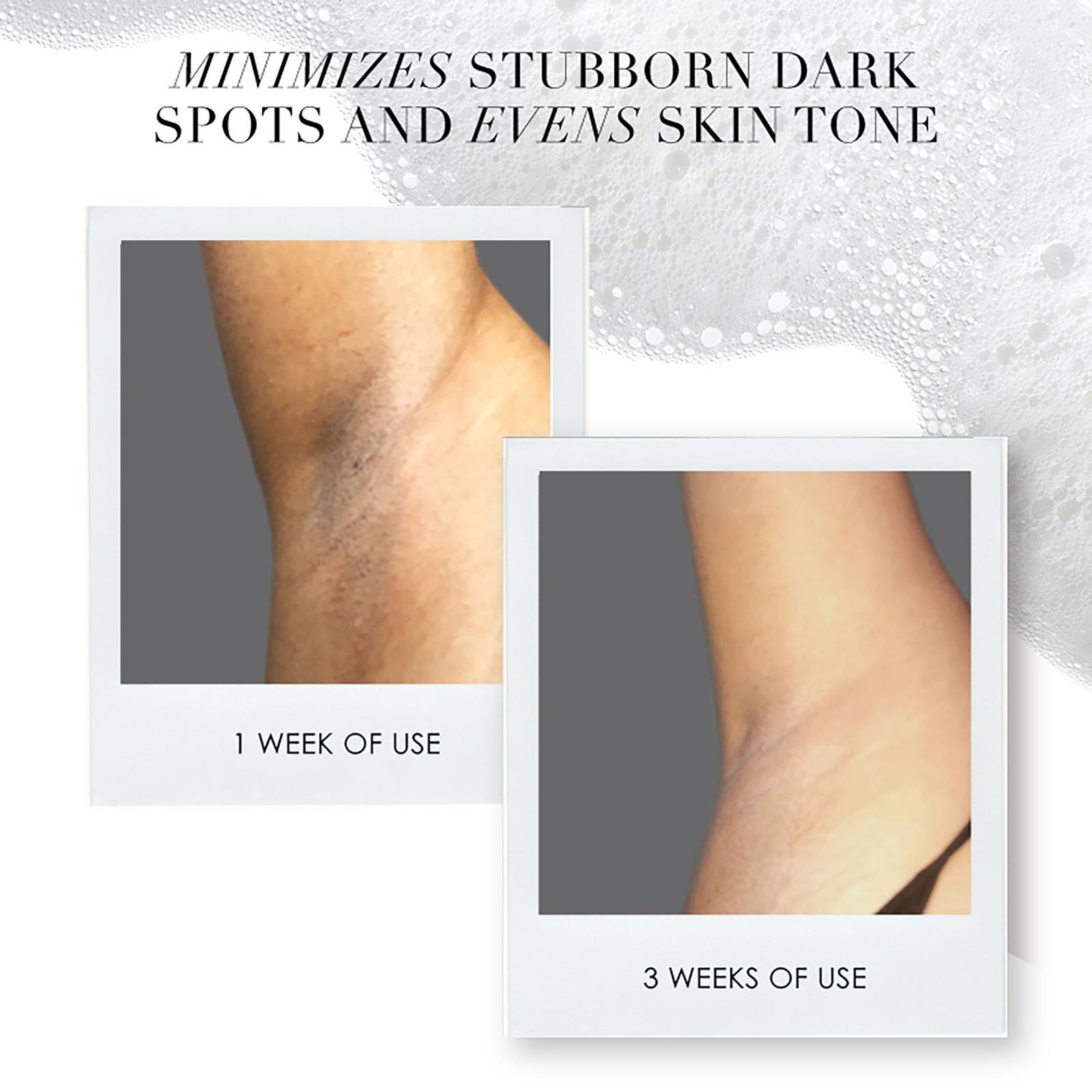 The Takesumi Bright 2-Step System for Brightening Underarms