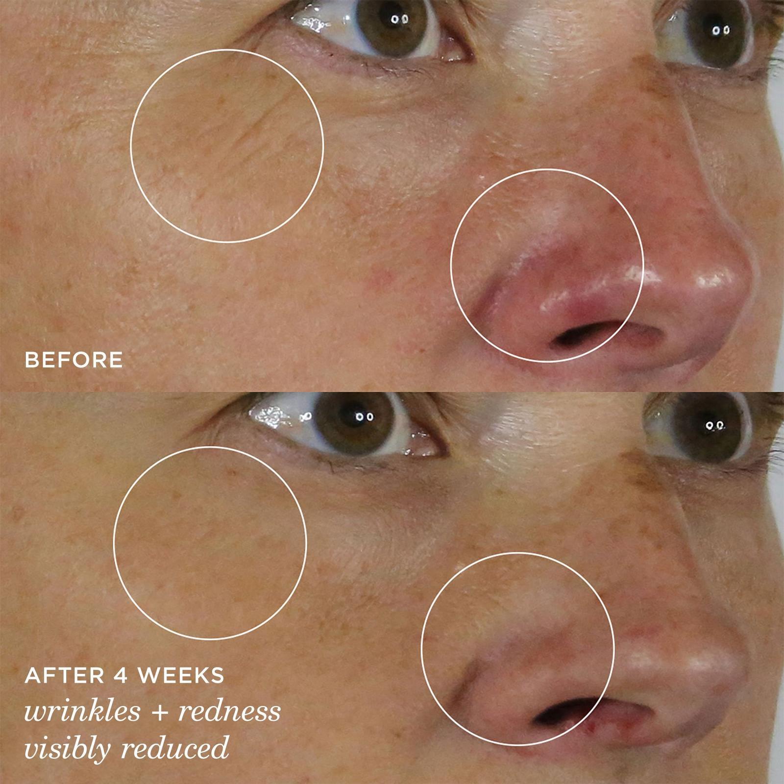 The Silk Serum Wrinkle-Smoothing Peptide + Retinol Alternative