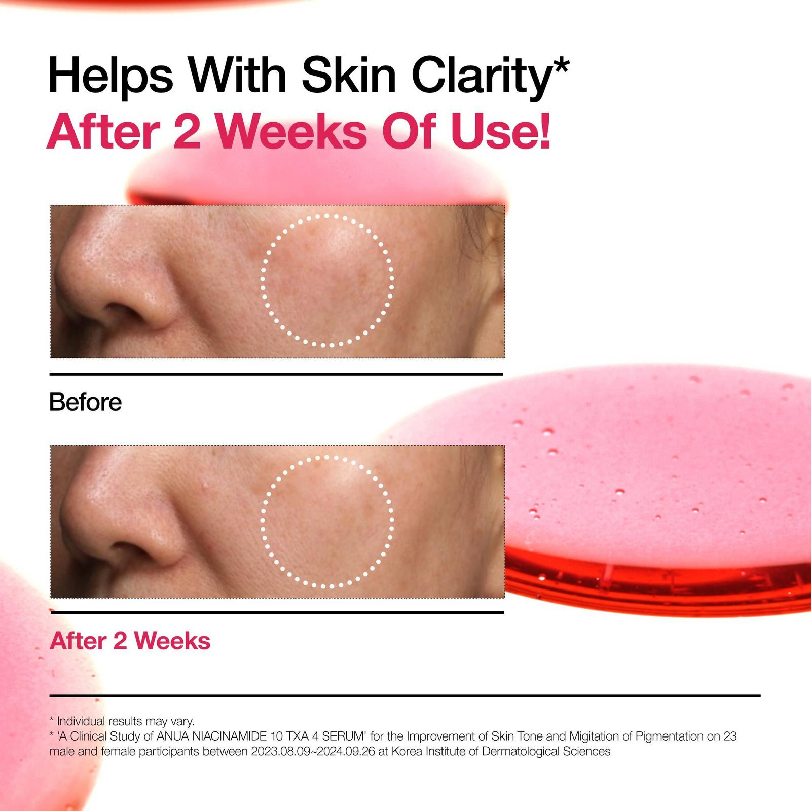 Niacinamide 10% TXA 4% Serum