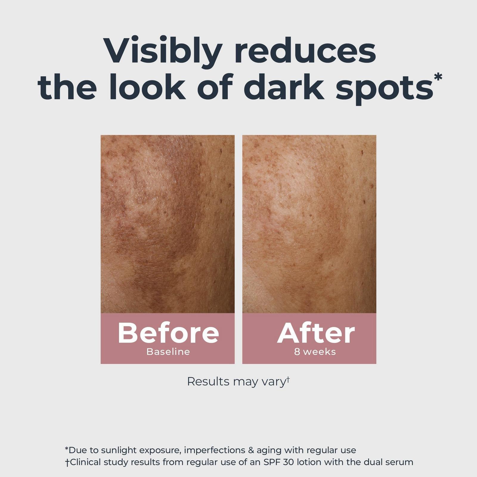 Radiant Tone Dual Serum Dark Spot Corrector