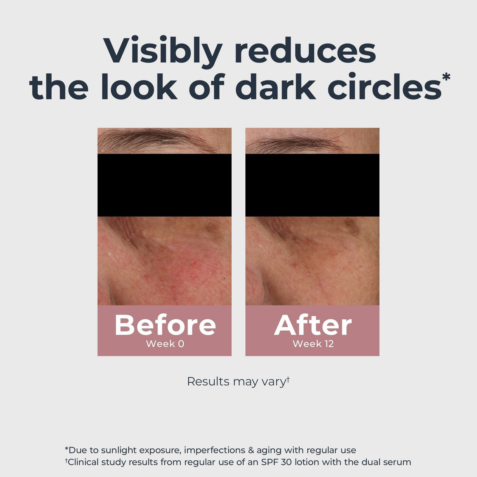 Radiant Tone Eye Cream Dark Circle Corrector