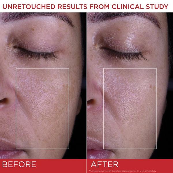 L'Oréal Revitalift Triple Power Face and Neck Moisturizer SPF 30 #4