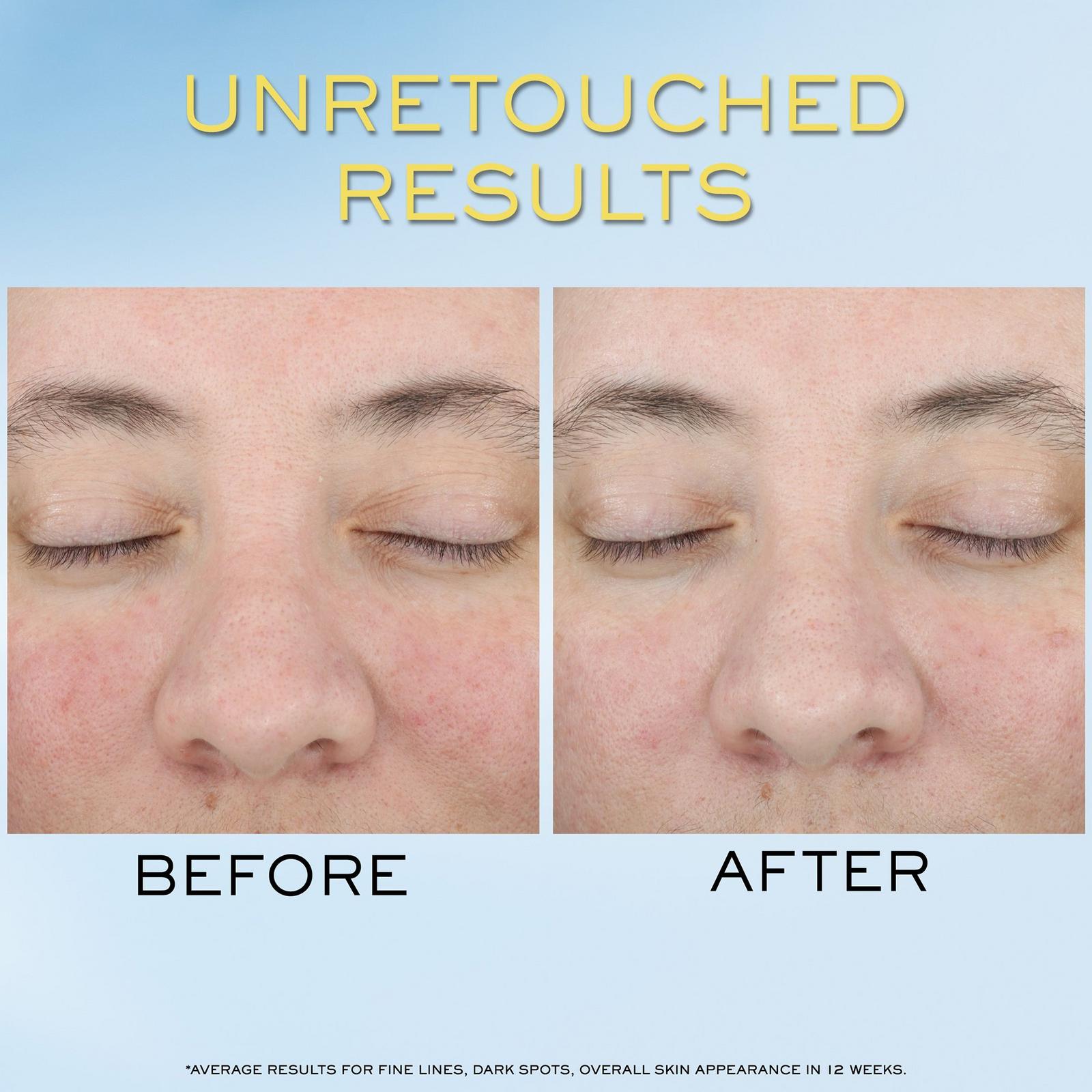 UV Expert Supra Screen Invisible Sunscreen Serum SPF 50+