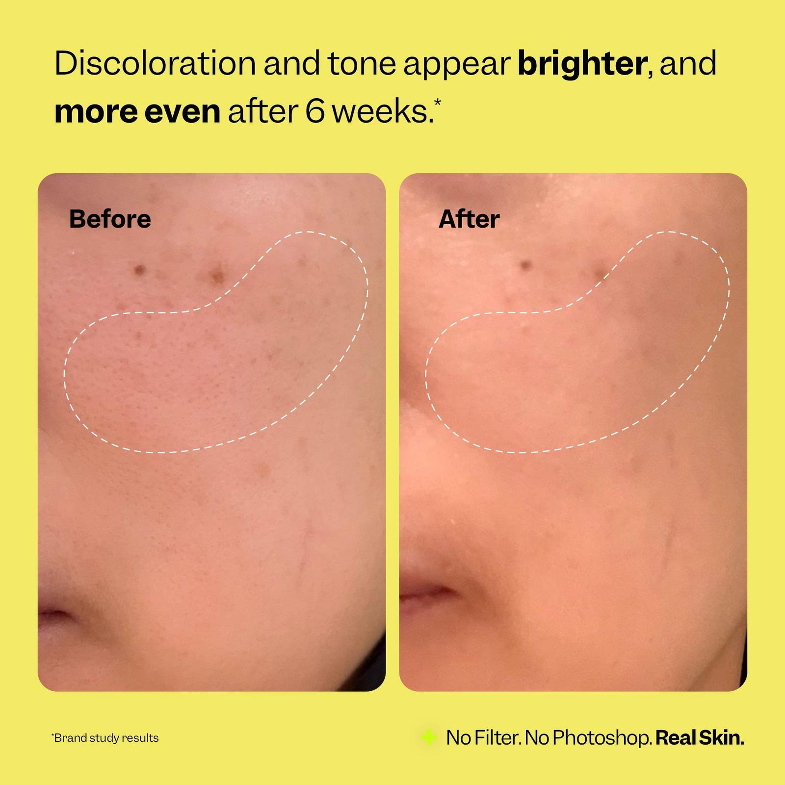 Super Fade Discoloration Serum