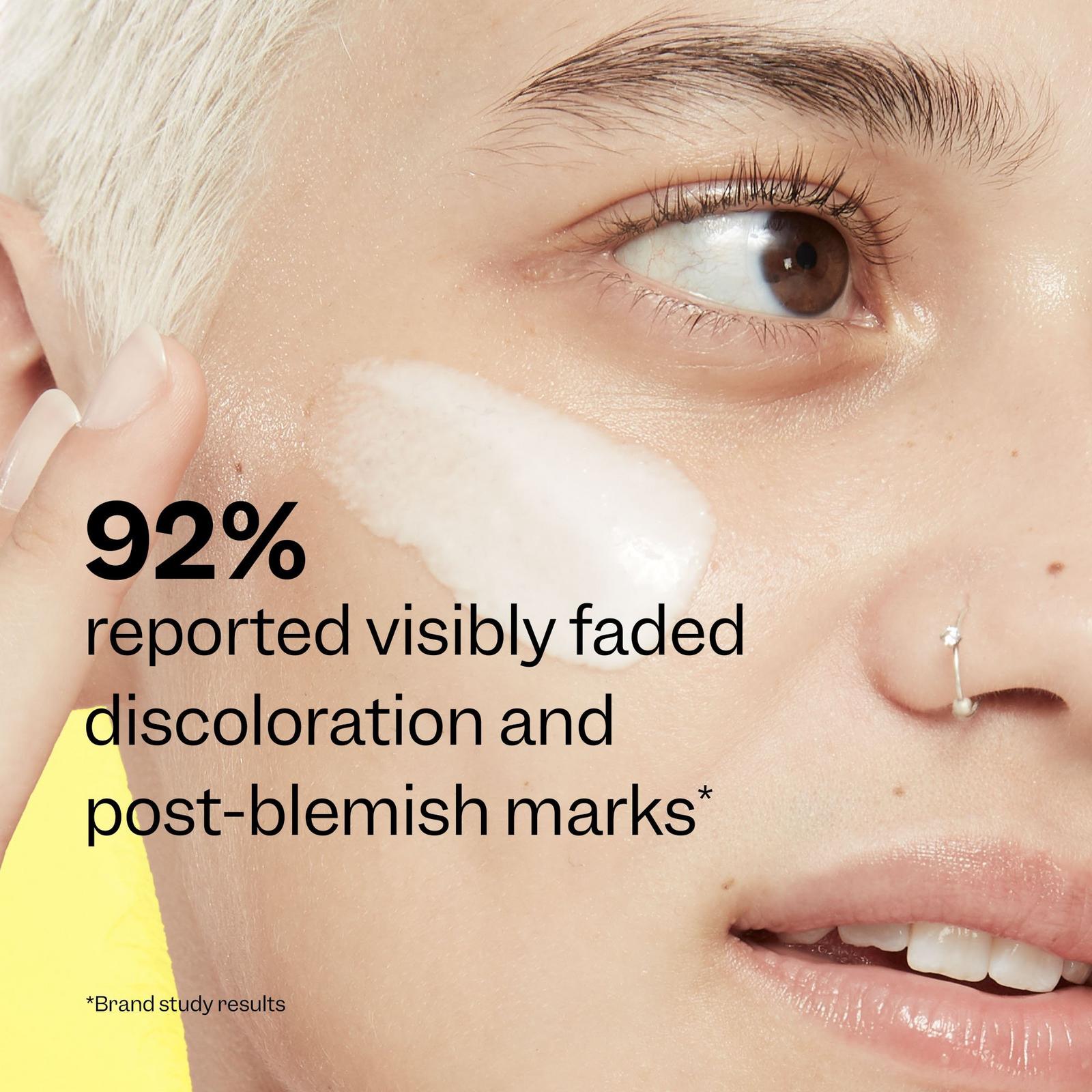 Super Fade Discoloration Serum