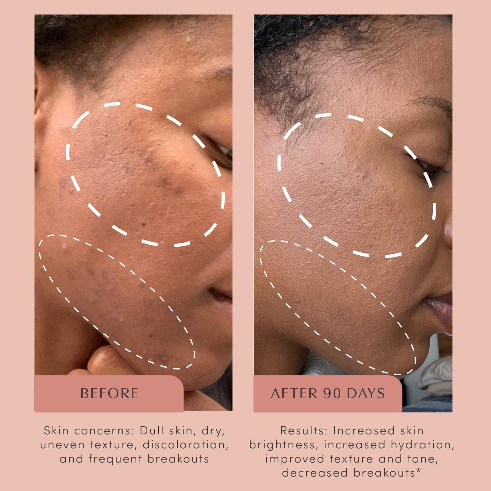 The Honest Youth Skin Support Tincture
