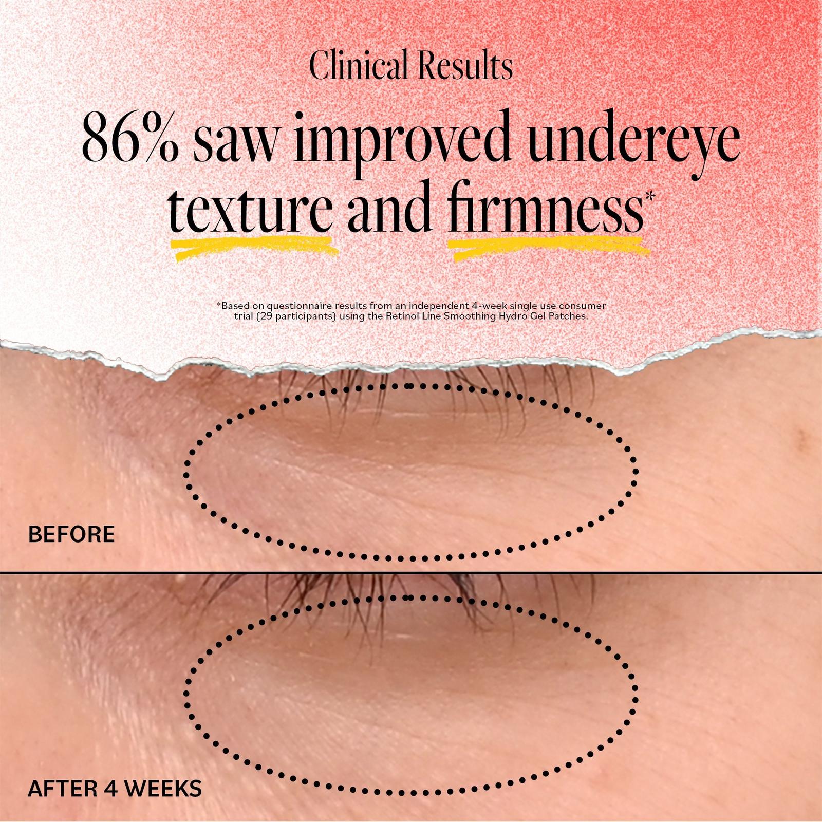 Retinol Line Smoothing Hydro Gel Patches - 60 ct