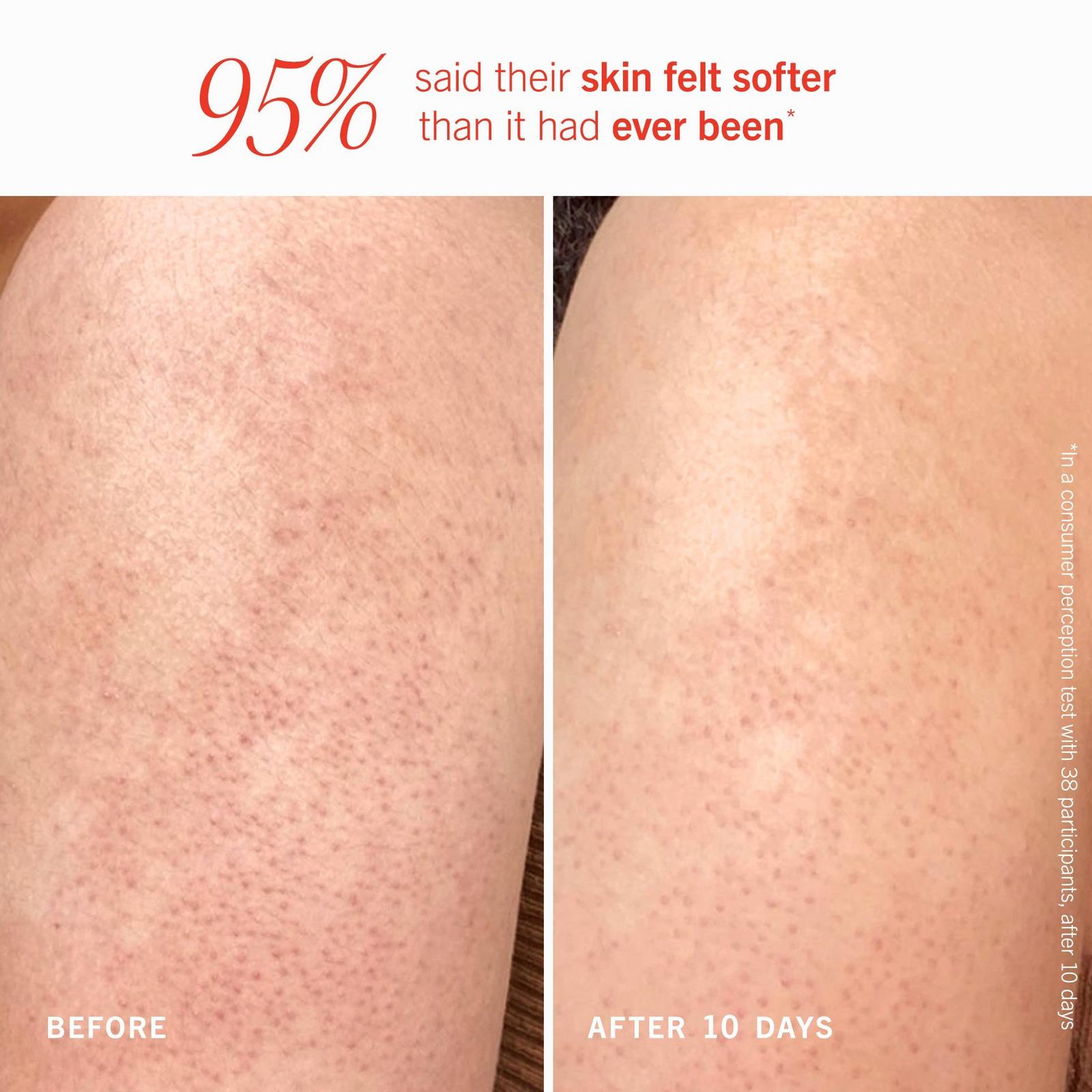 KP Bump Eraser Body Scrub with 10% AHA Fresh Peach