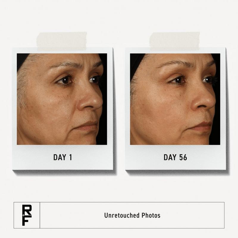 RODAN + FIELDS - Total RF Serum Anti-Wrinkle Face Serum | Ulta Beauty