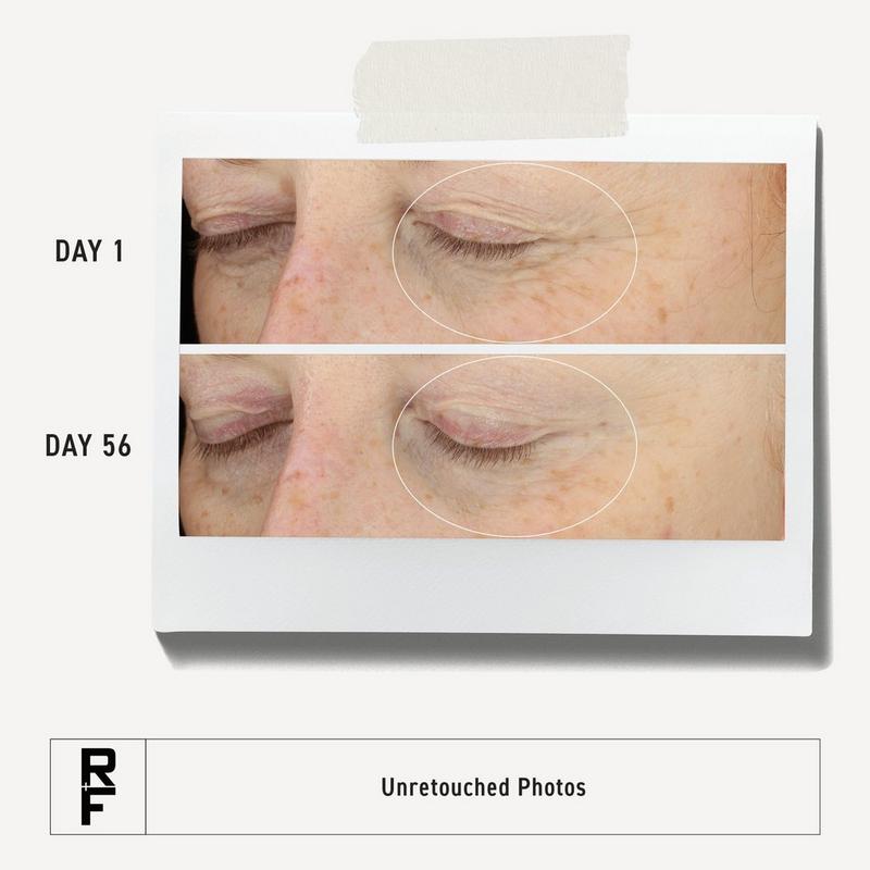 RODAN + FIELDS Redefine Multi-Function Eye Cream for Undereye Wrinkles + Crow's Feet #5