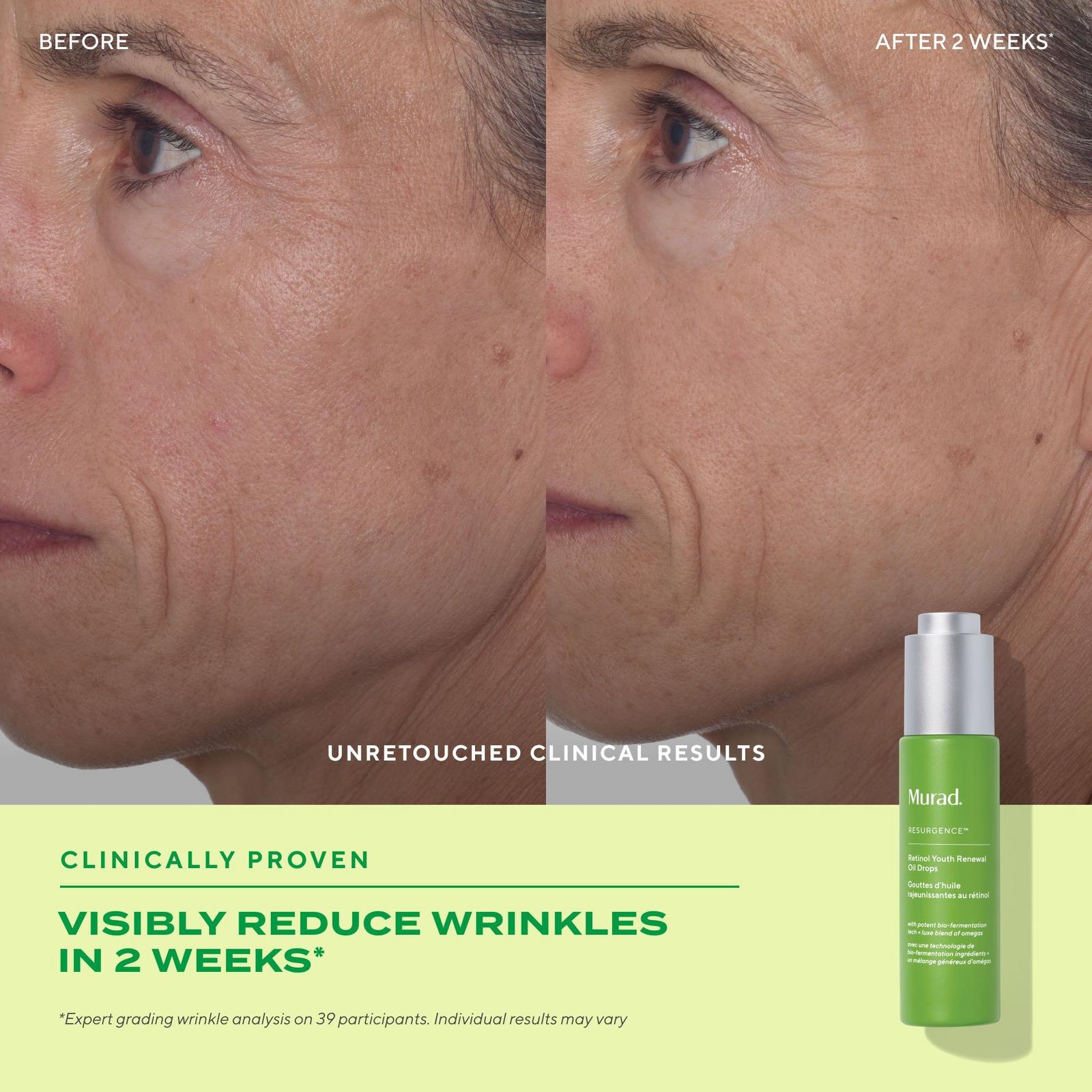 Retinol Youth Renewal Face Oil Drops