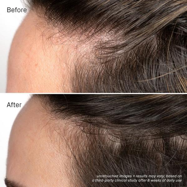 isima Iconic Densifying Scalp Serum #5