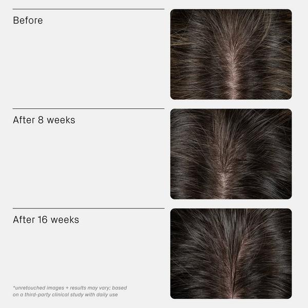 isima Iconic Densifying Scalp Serum #6