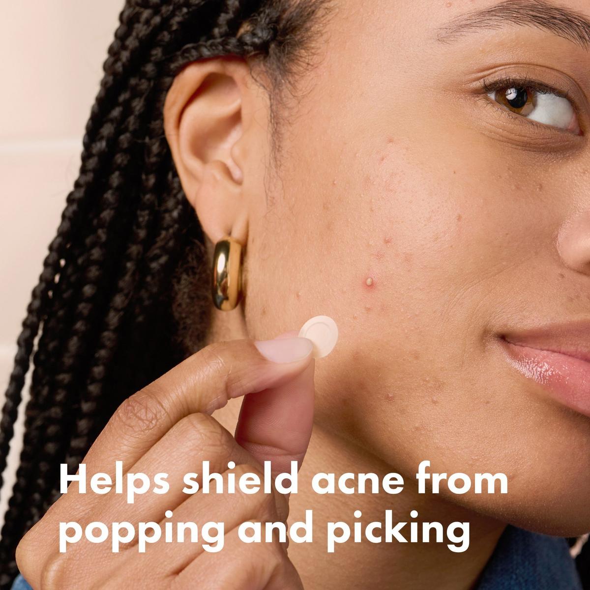 Mighty Patch Invisible+ Daytime Hydrocolloid Acne Pimple Patches - 72 ct