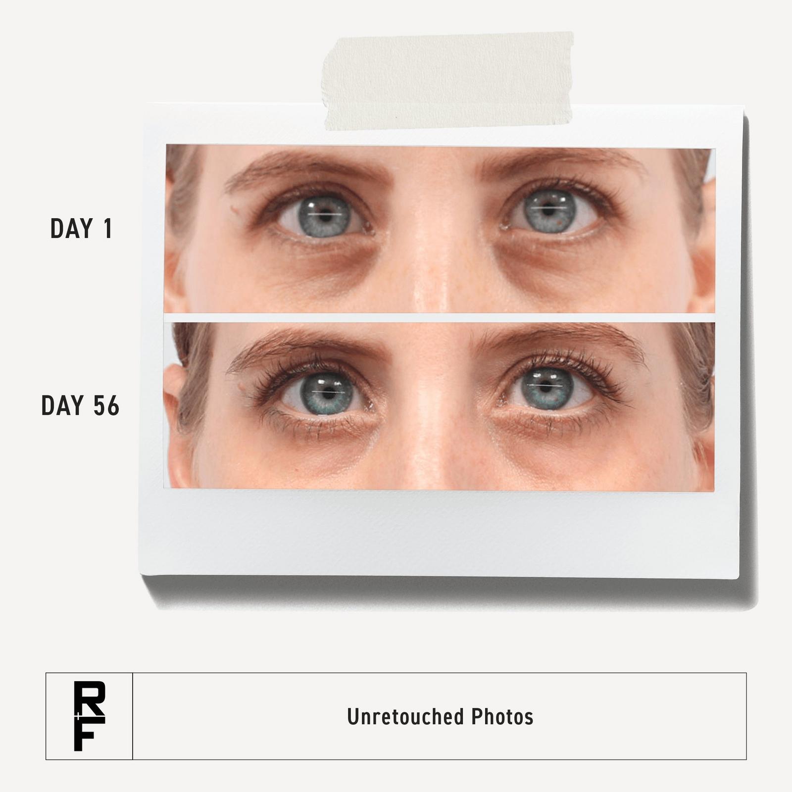 Active Hydration Bright Eye Complex