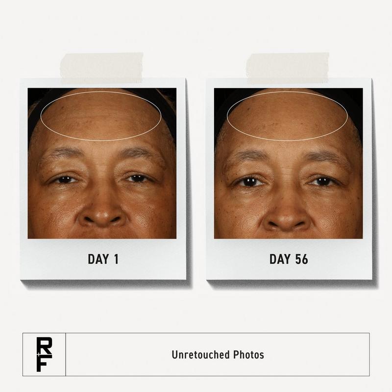 RODAN + FIELDS - Redefine 30-Day Regimen for Fine Lines and