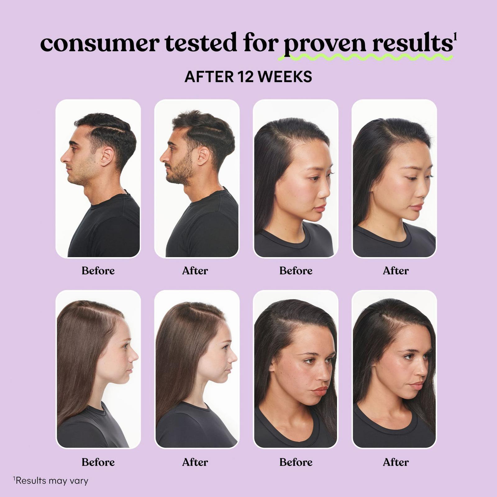 Grow: Hair Growth & Anti-Shedding Capsules
