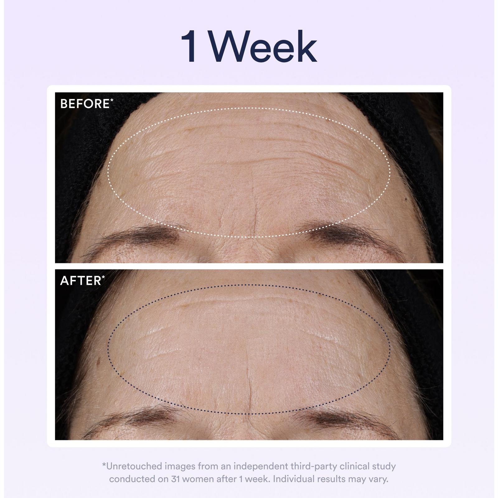 Dream Night Serum with Bio-Retinol