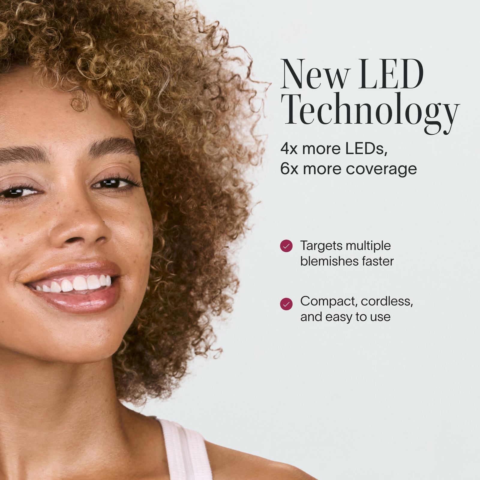 Bye Acne: 3-Minute Blue + Red Light Therapy Acne Treatment