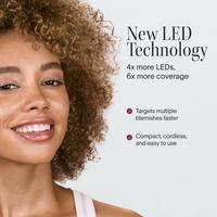 Solawave Bye Acne: 3-Minute Blue + Red Light Therapy Acne Treatment #2