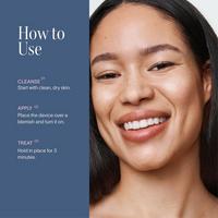 Solawave Bye Acne: 3-Minute Blue + Red Light Therapy Acne Treatment #5