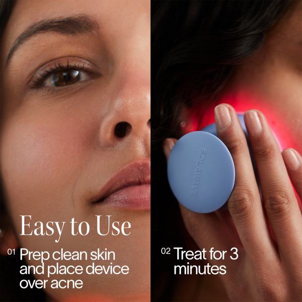 Solawave Bye Acne: 3-Minute Blue + Red Light Therapy Acne Treatment #8