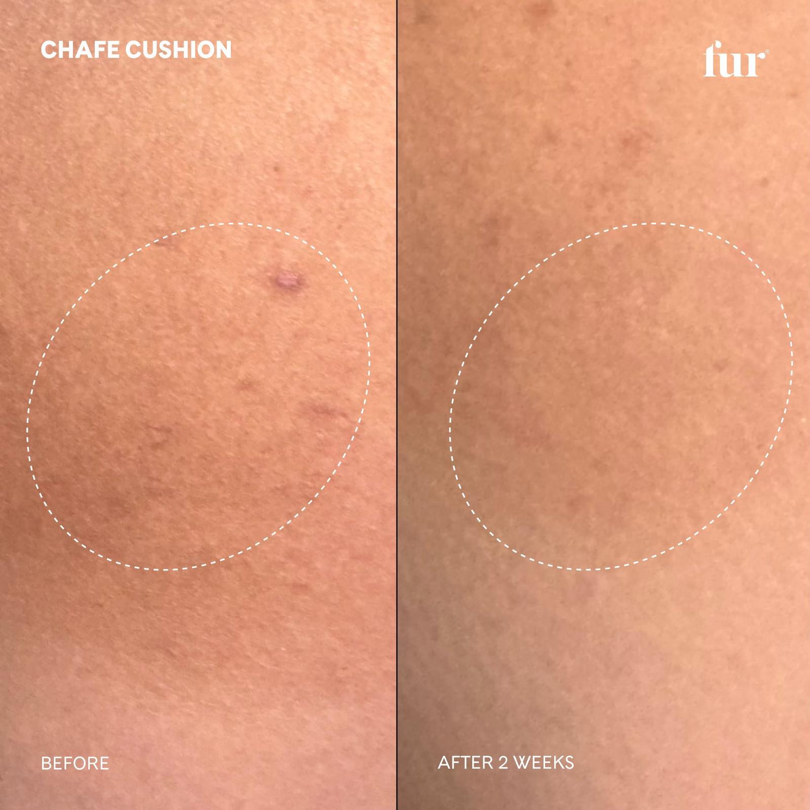 Chafe Cushion