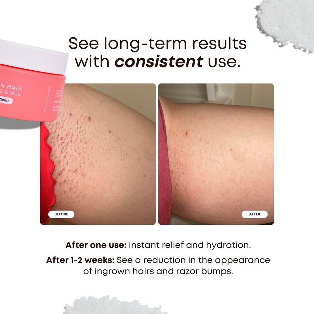 Ingrown Hair Exfoliating Scrub - Watermelon Sugar