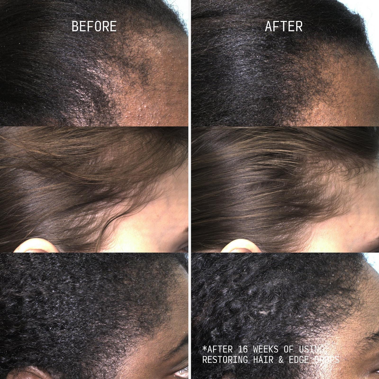 Restoring Hair & Edge Drops