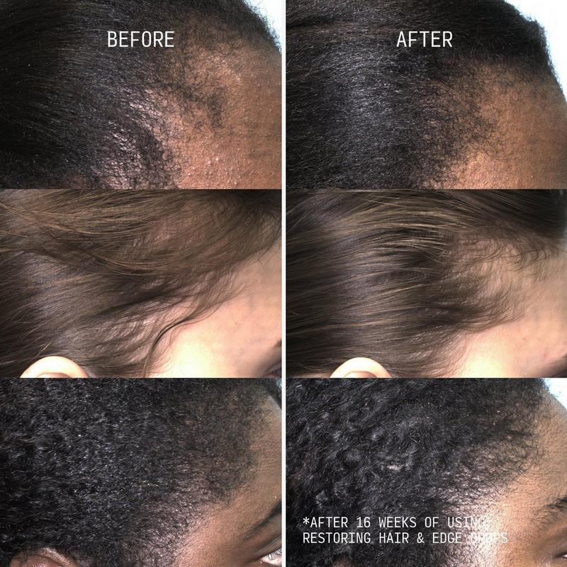 CÉCRED Restoring Hair & Edge Drops #3