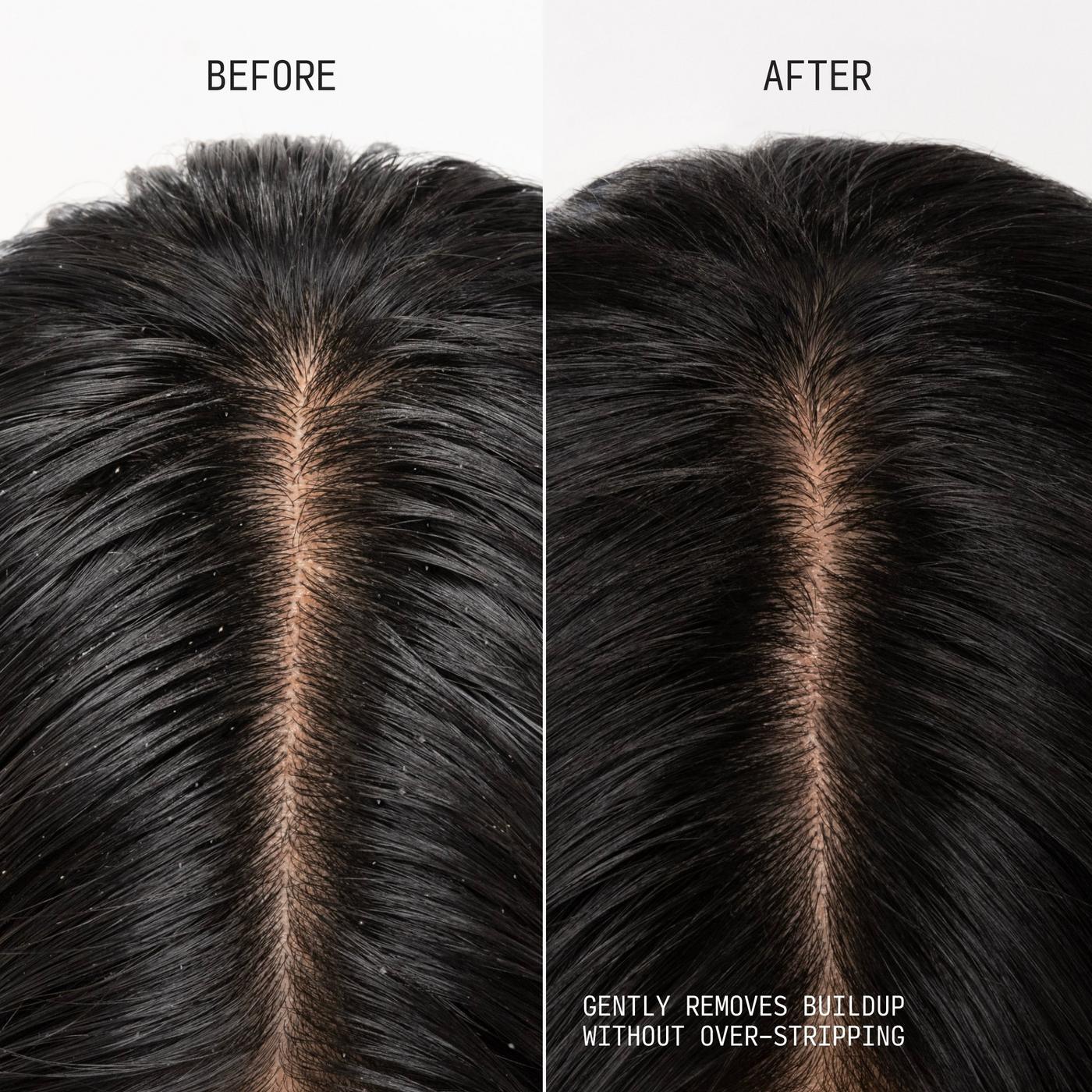 Travel Size Clarifying Shampoo & Scalp Scrub