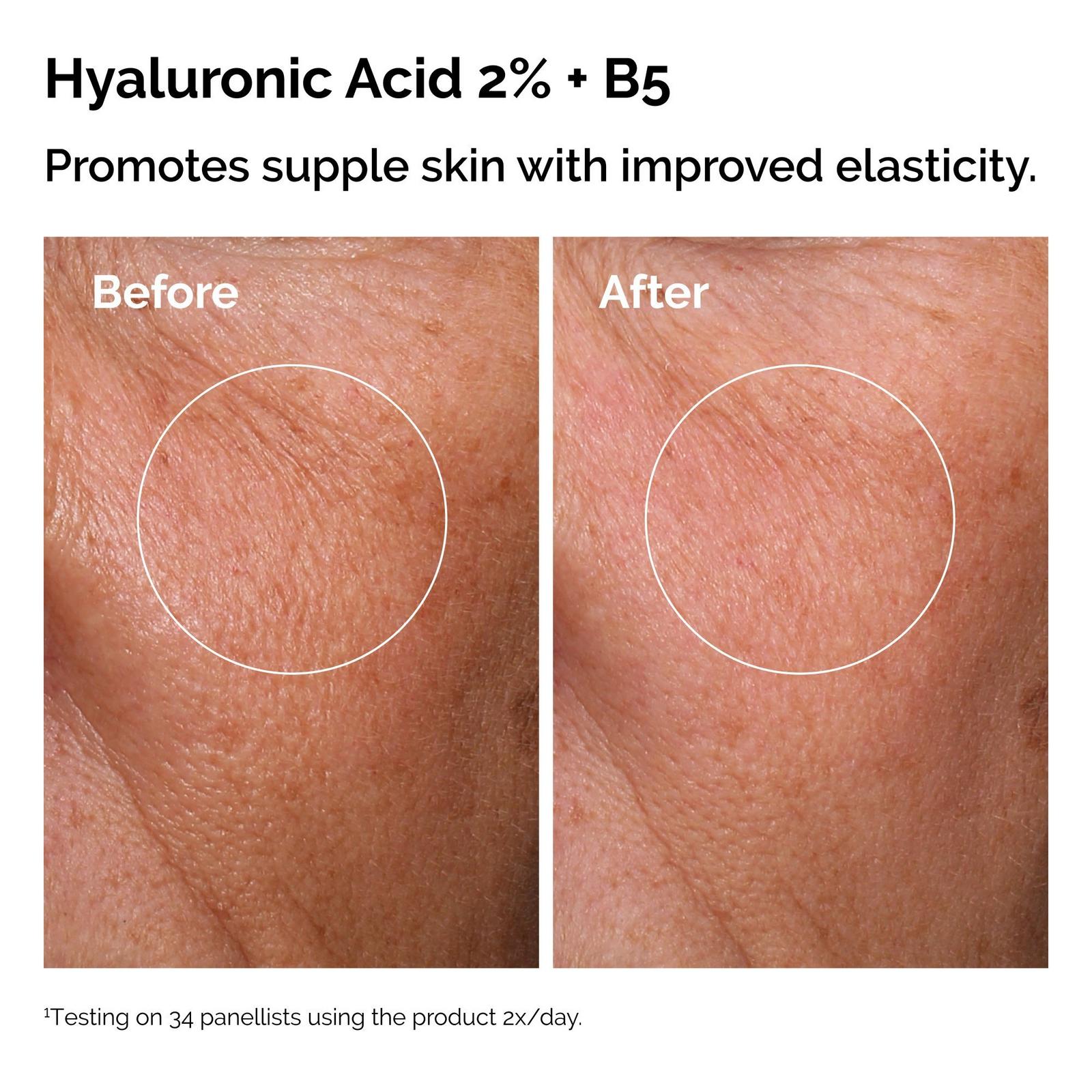 The Daily Set with Hyaluronic Acid Serum