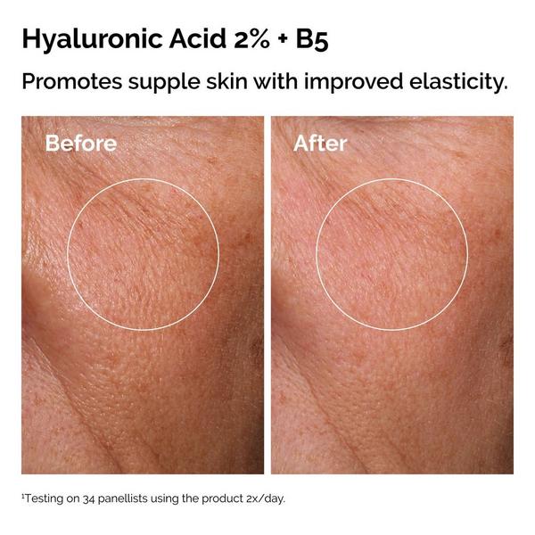 The Ordinary The Daily Set with Hyaluronic Acid Serum #3