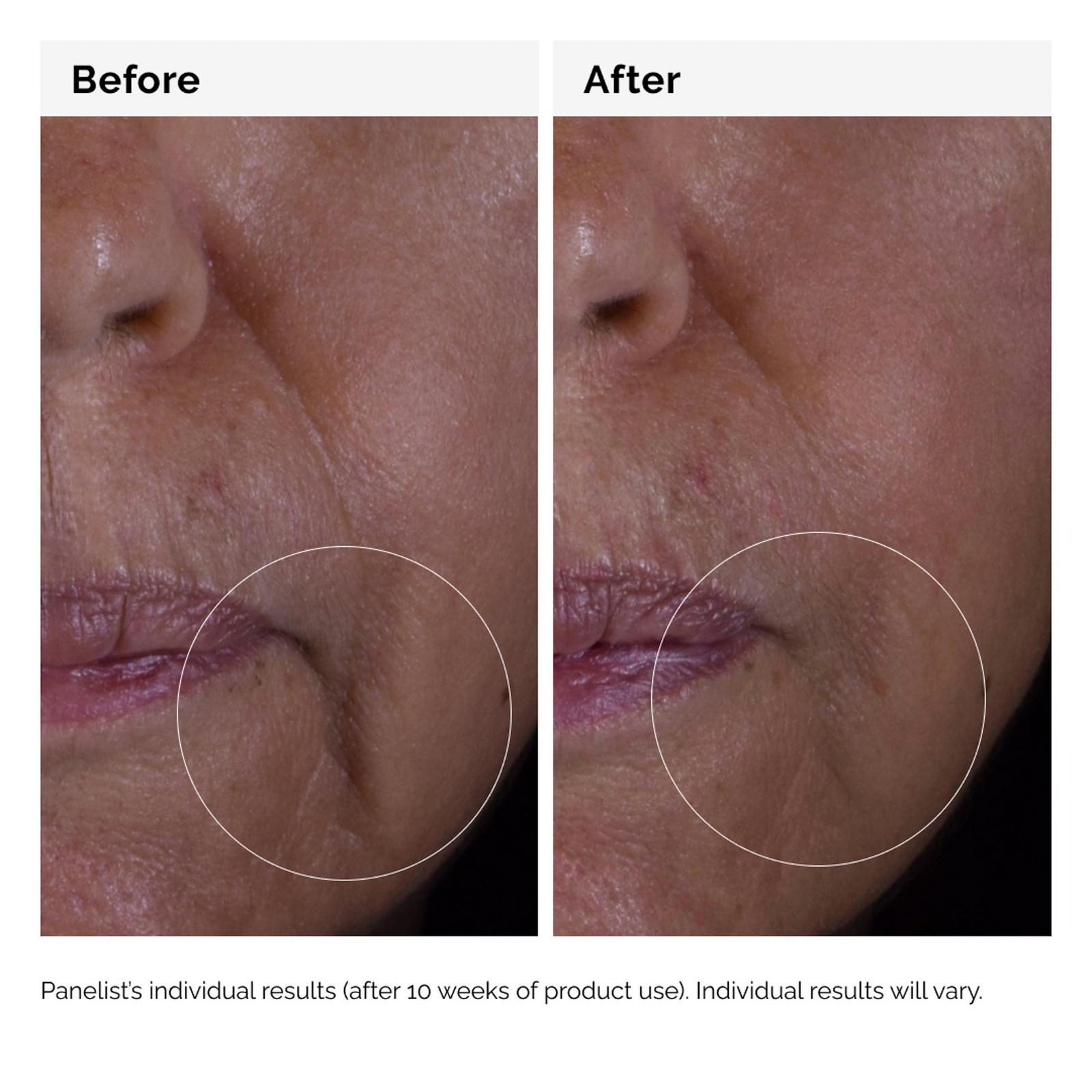 GF 15% Serum for Visible Skin Repair and Wrinkles