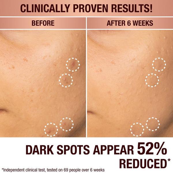 Charlotte Tilbury Dark Spot Correcting Radiance Recovery Serum #2