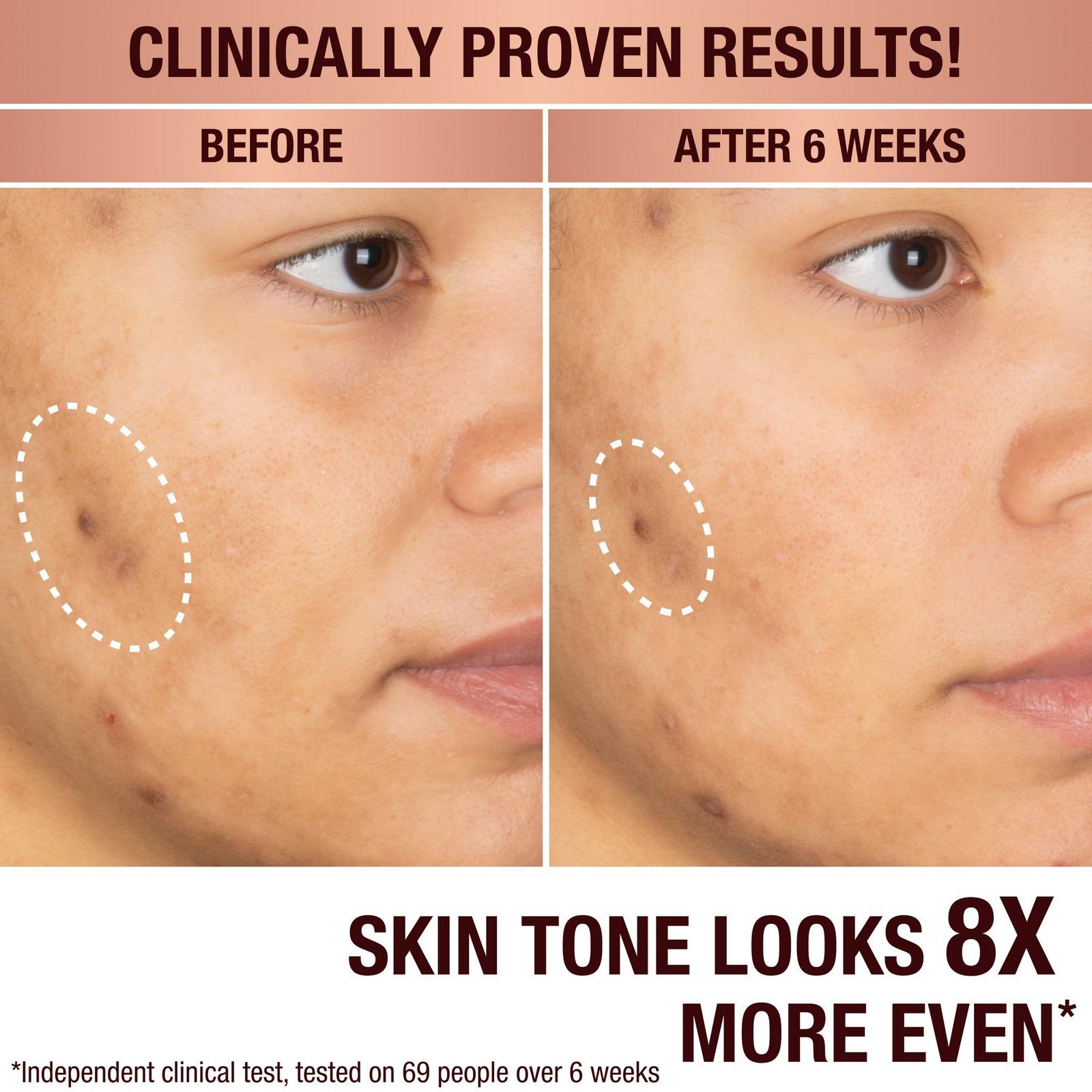 Dark Spot Correcting Radiance Recovery Serum - 1.0 oz