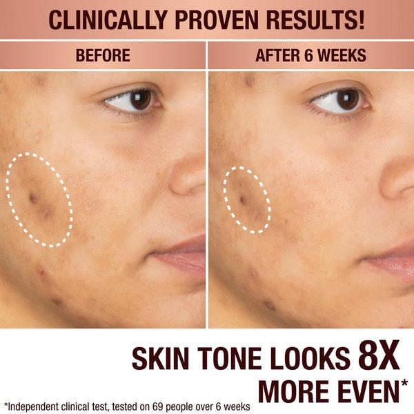 Charlotte Tilbury Dark Spot Correcting Radiance Recovery Serum #3