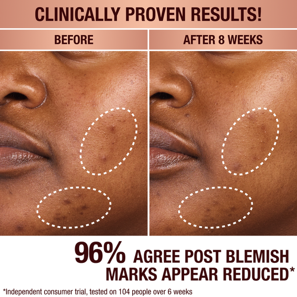 Charlotte Tilbury Dark Spot Correcting Radiance Recovery Serum #6