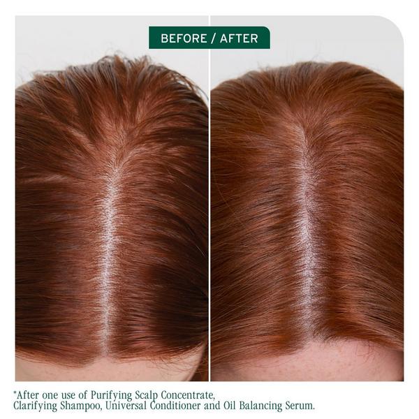 Biolage Scalp Sync Clarifying Shampoo for Oily Scalp #7