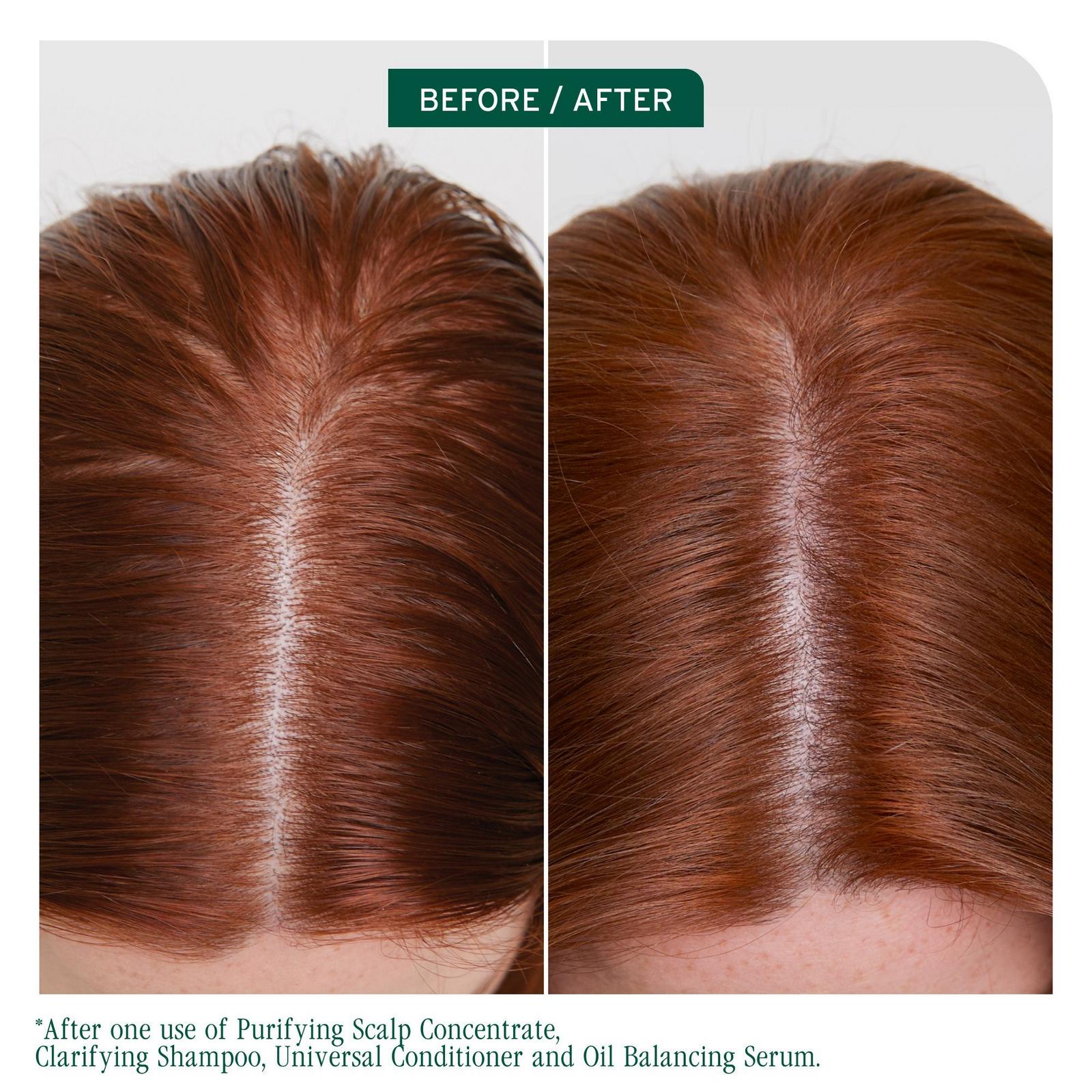 Scalp Sync Clarifying Shampoo