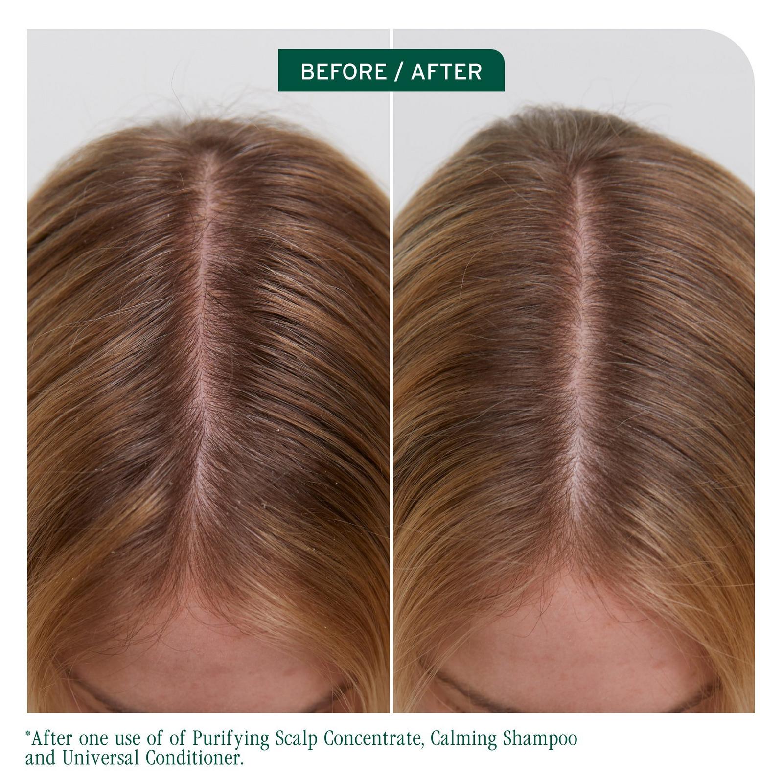 Biolage - Scalp Sync Purifying Concentrate | Ulta Beauty Biolage - Scalp Sync Purifying Concentrate | Ulta Beauty