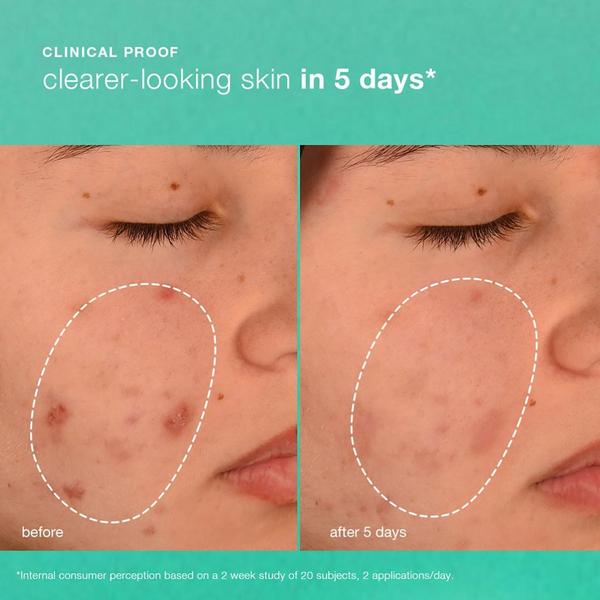 Dermalogica Acne Biotic Moisturizer #5