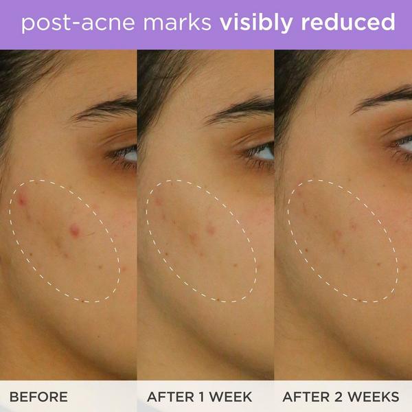 TATCHA The Brightening Serum #3