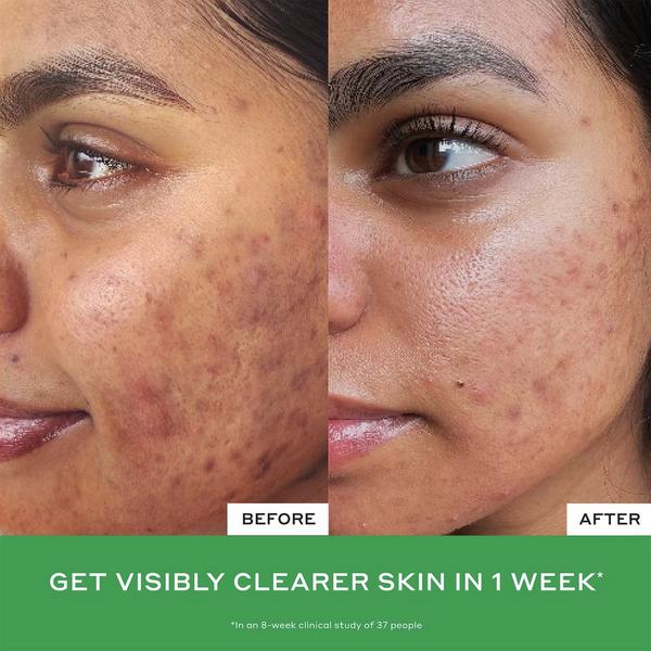 OLEHENRIKSEN Daily D-Clog Pore-Clearing Cleanser #4