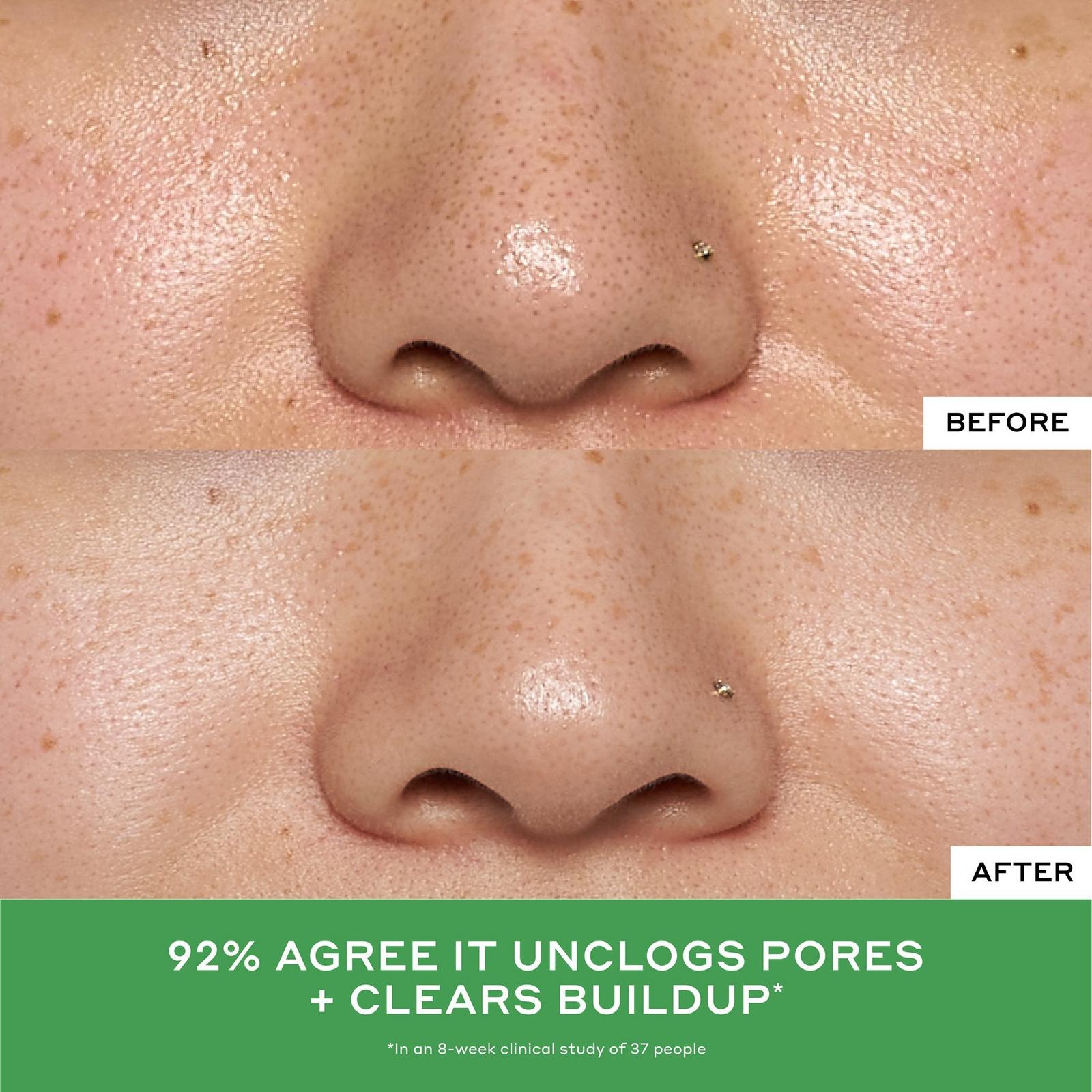 Detox Drops 2% Salicylic Acid Acne Toner